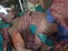 चारापत्ती लेने गयी महिला पर भालू ने किया हमला, स्थिति गम्भीर