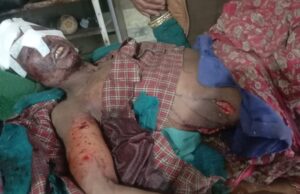 चारापत्ती लेने गयी महिला पर भालू ने किया हमला, स्थिति गम्भीर