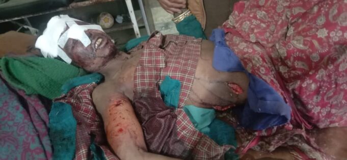 चारापत्ती लेने गयी महिला पर भालू ने किया हमला, स्थिति गम्भीर