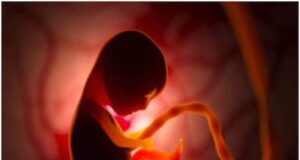 आश्चर्य : चार दिन पहले जन्मी बच्ची के पेट मे मिला बच्चा