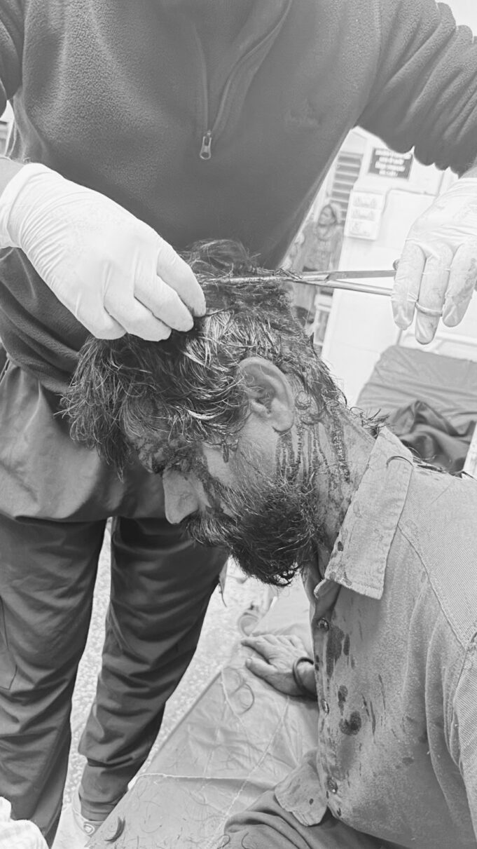 भालू ने एक व्यक्ति को किया घायल,बाल बाल बची जान,दहशत में ग्रामीण