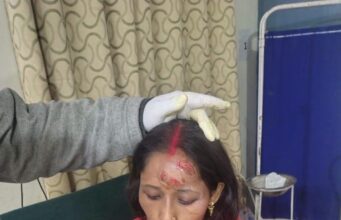 जोशीमठ में भालू का आतंक, एक ही परिवार के चार लोगों पर हमला; सभी गंभीर घायल