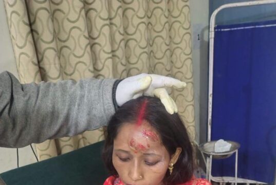 जोशीमठ में भालू का आतंक, एक ही परिवार के चार लोगों पर हमला; सभी गंभीर घायल