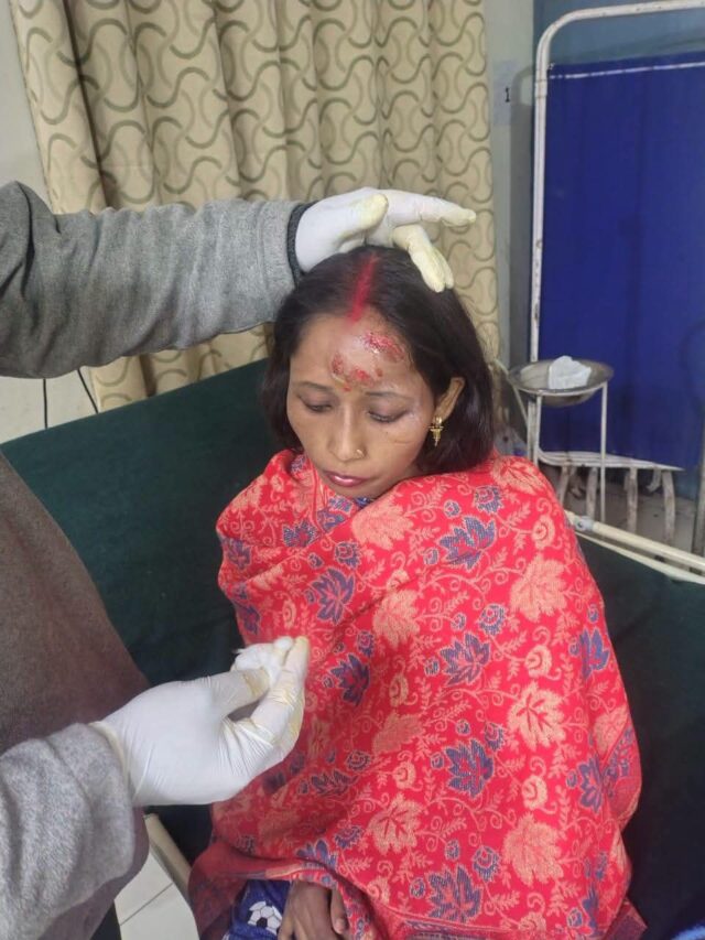 जोशीमठ में भालू का आतंक, एक ही परिवार के चार लोगों पर हमला; सभी गंभीर घायल