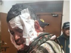 भालू के हमले में ग्रामीण गंभीर घायल, आबादी के आसपास बढ़ी सक्रियता से दहशत