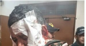 भालू के हमले में ग्रामीण गंभीर घायल, आबादी के आसपास बढ़ी सक्रियता से दहशत