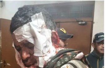 भालू के हमले में ग्रामीण गंभीर घायल, आबादी के आसपास बढ़ी सक्रियता से दहशत