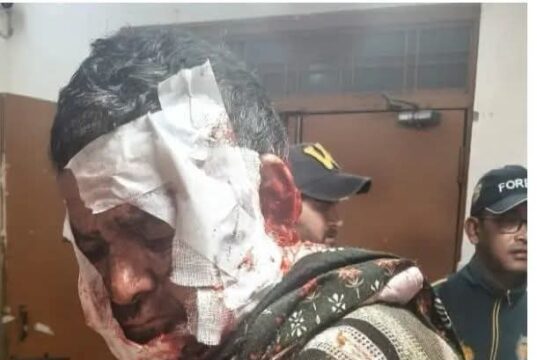 भालू के हमले में ग्रामीण गंभीर घायल, आबादी के आसपास बढ़ी सक्रियता से दहशत