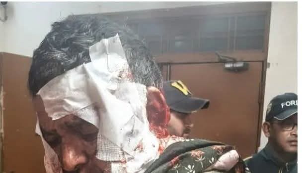 भालू के हमले में ग्रामीण गंभीर घायल, आबादी के आसपास बढ़ी सक्रियता से दहशत